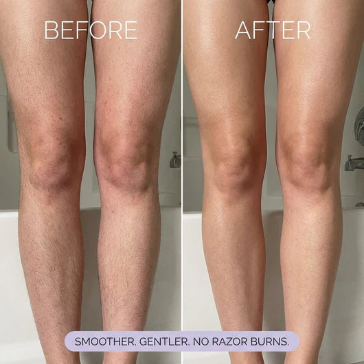 Truvera Hair Removal Mousse