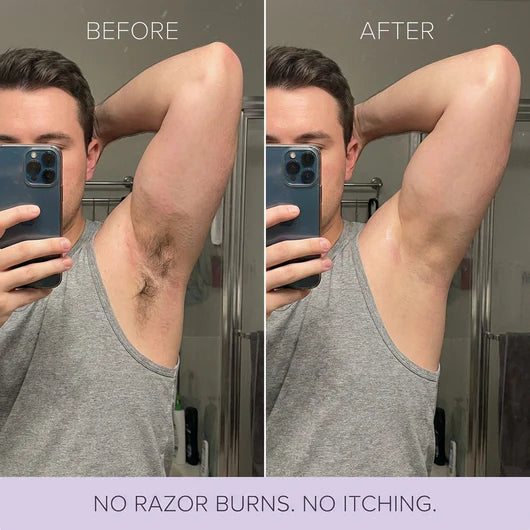 Truvera Hair Removal Mousse
