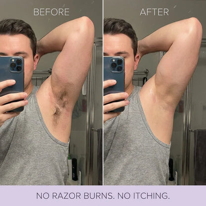 Truvera Hair Removal Mousse